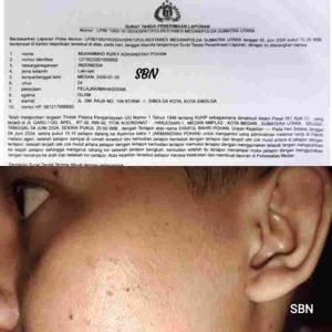 Pelaku Penganiayaan Ayah dan Paman Cs Terhadap Anak Kandung Belum Tertangkap