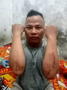 Noferius Gulo Minta Polrestabes Medan Segera Tangkap Pelaku Penganiayaan